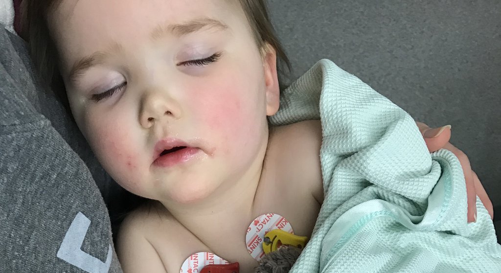 Bulging Fontanel Causes, Treatments, And When To See A, 60 OFF