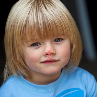 Meningitis amputee Riley Dingle